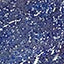 N.692 BLUE GLITTER